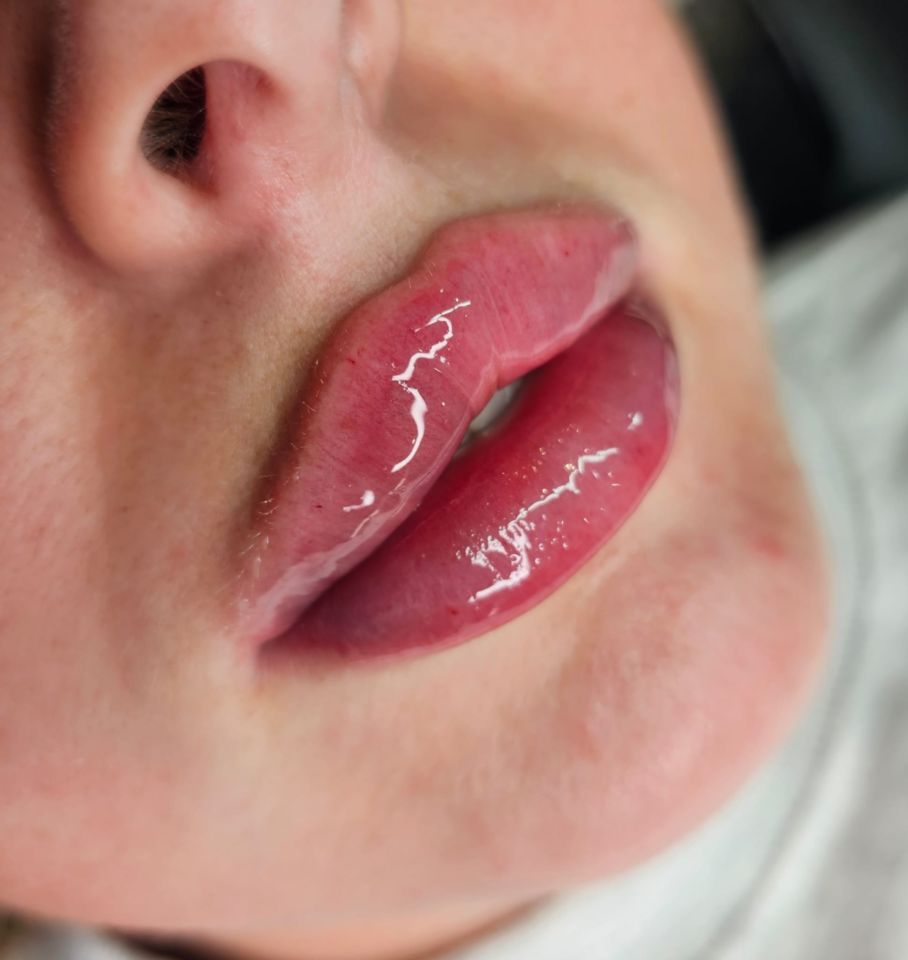 Lip enhancement result close-up