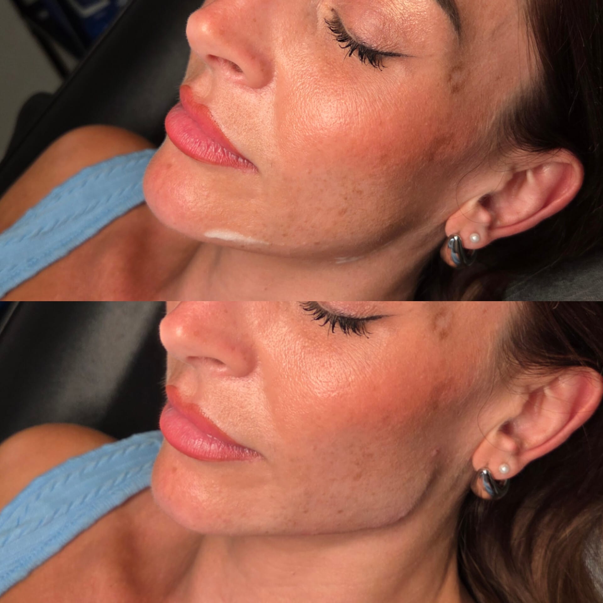 Skin and profile results comparison
