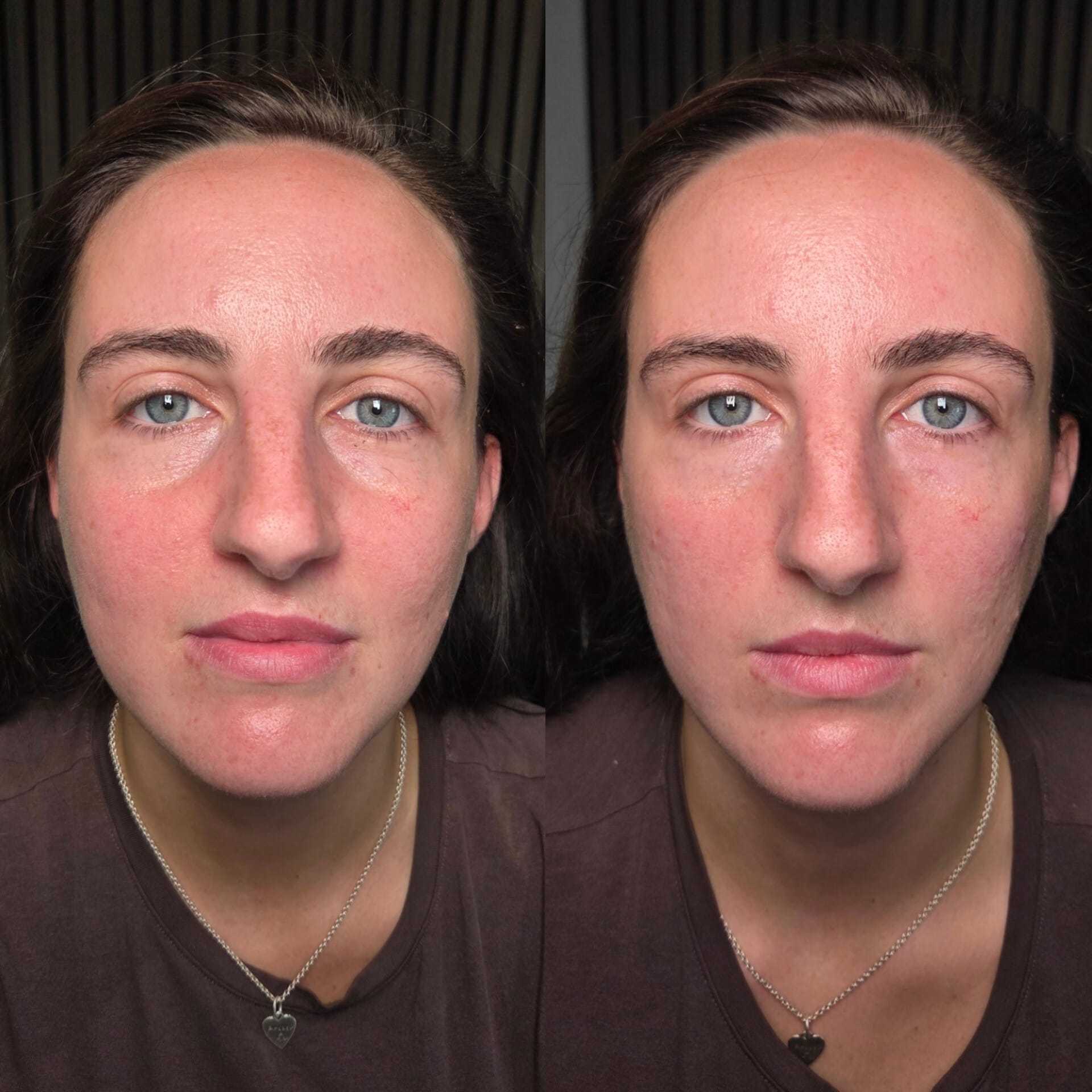 Facial skin before and after comparison