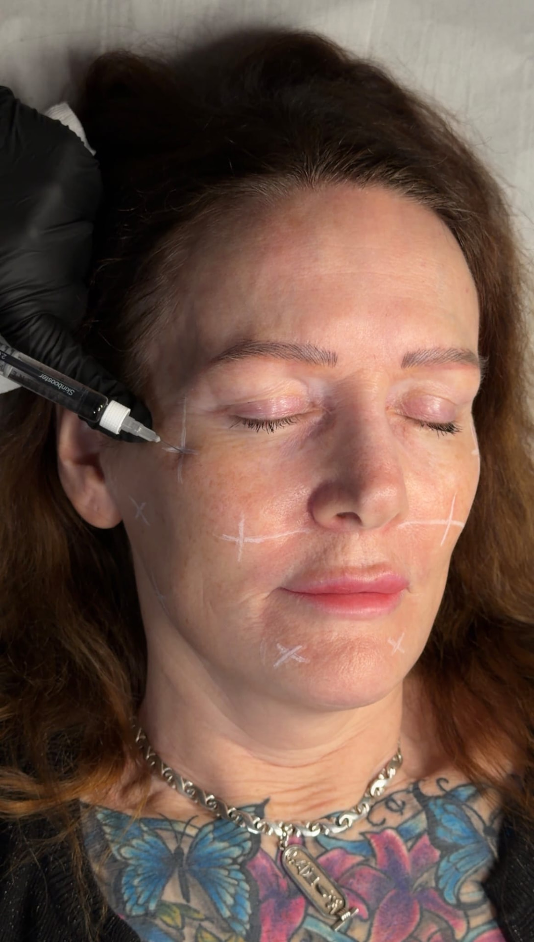 Skin Boosting Facial